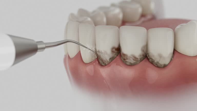 Reliable Dental contractor in Columbus, MT by Smile Center Dentistry